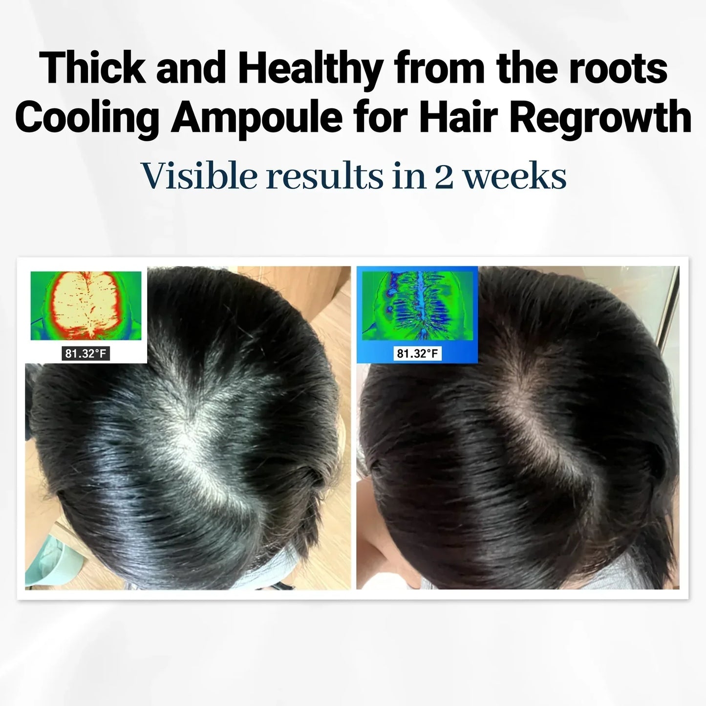 Alurain™ Hair Growth Serum