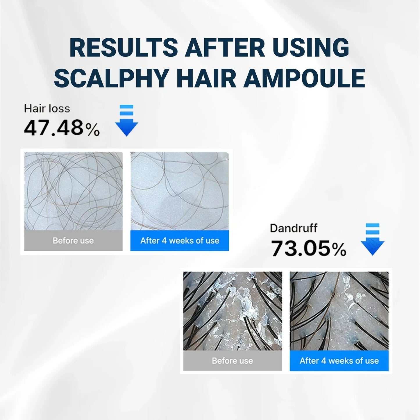 Alurain™ Hair Growth Serum