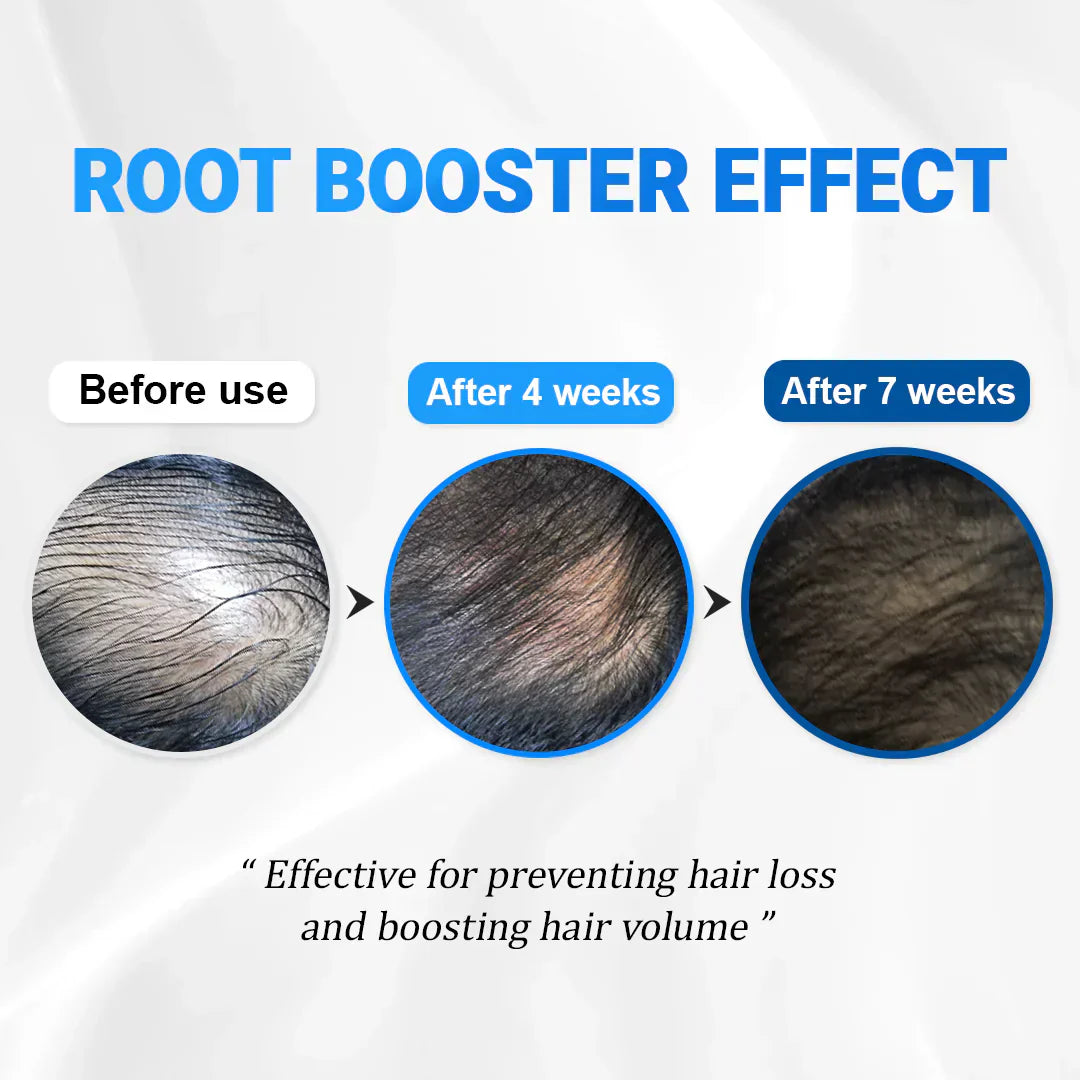 Alurain™ Hair Growth Serum
