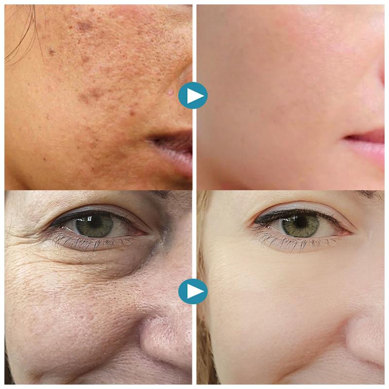 PurePores™ Instant Pore Minimizer