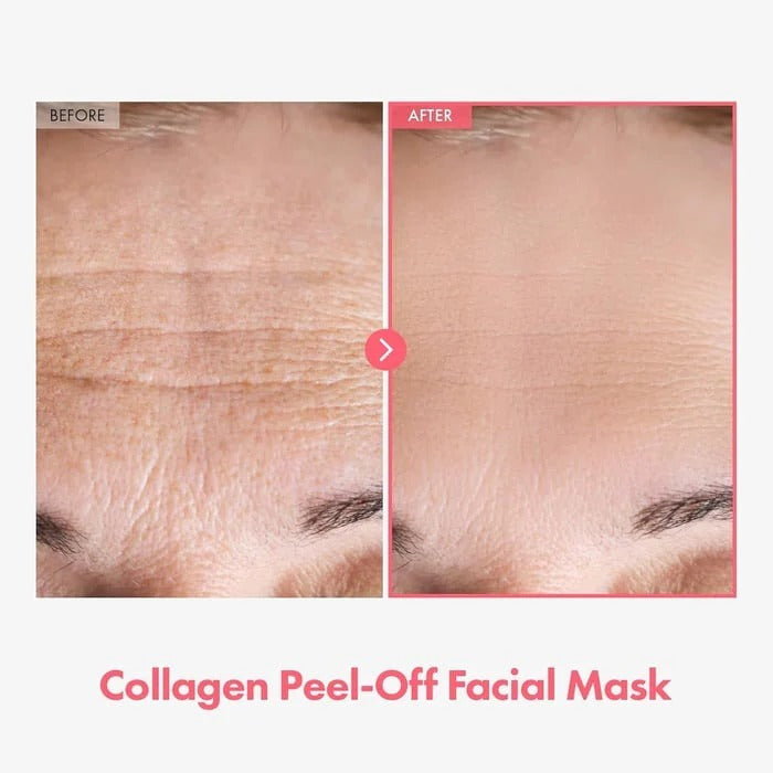 Alurain™ Collagen Mask