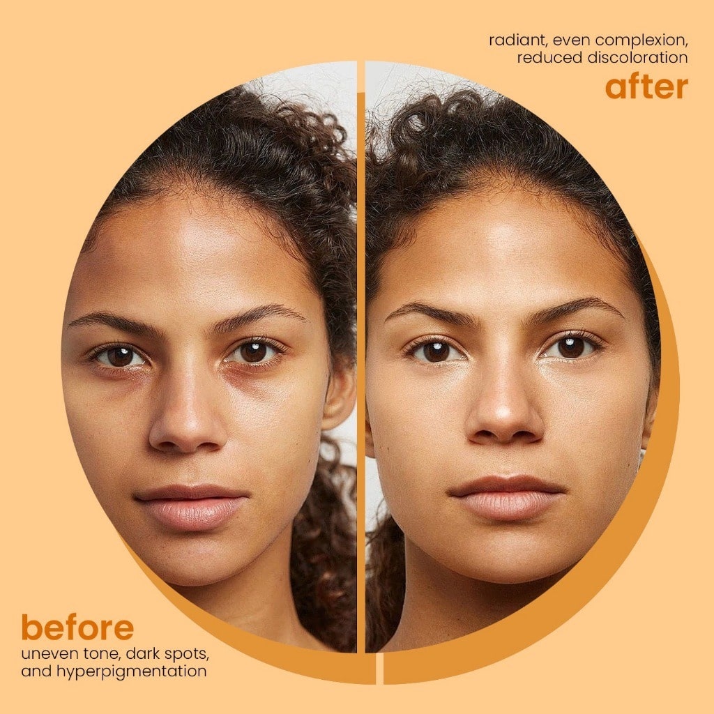 Alurain™ | Pure Light For Your Skin