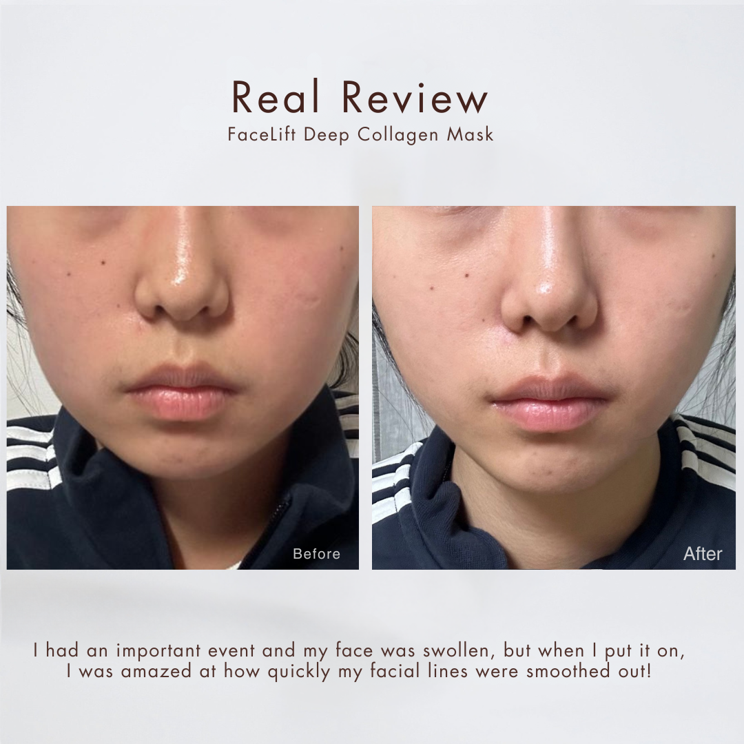 Alurain™ Collagen Mask | TODAY ONLY