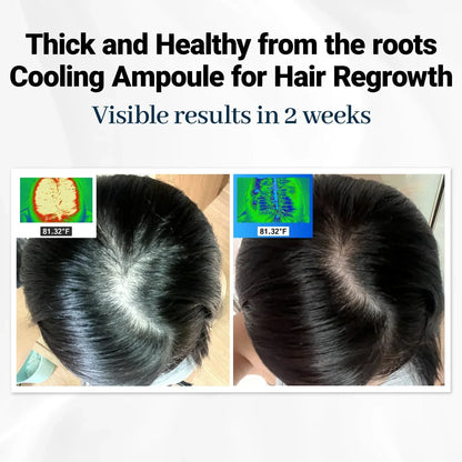Alurain™ Hair Growth Serum