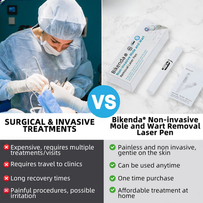 Molde® Non-Invasive Mole and Wart Removal Laser Pen Promax