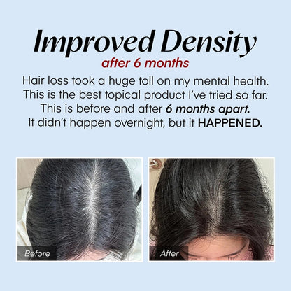 Alurain™ Serum – Revitalize fresh, thick hair and soothe your scalp all day long