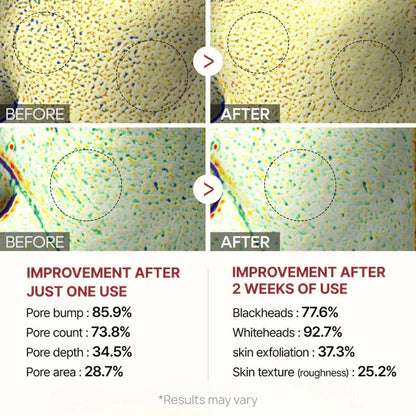 GlowRevive™ - Erase Years of Sun Damage Naturally (+ FREE Mystery bonus)