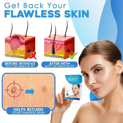 Eaksone - fast auto tag removal kit