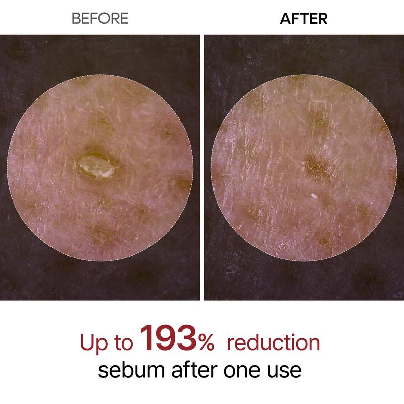 GlowRevive™ - Erase Years of Sun Damage Naturally (+ FREE Mystery bonus)
