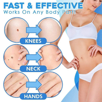 Eaksone - fast auto tag removal kit