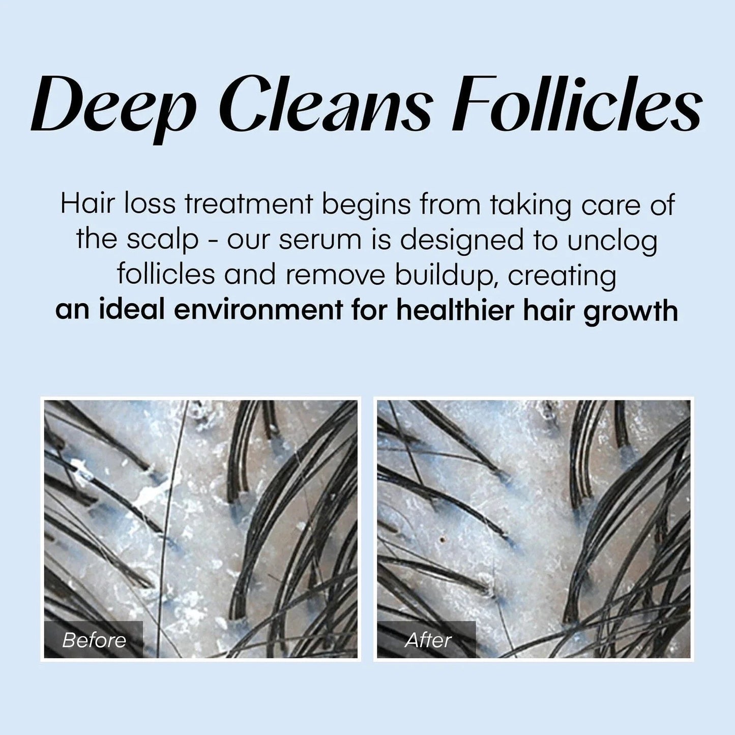 Alurain™ Serum – Revitalize fresh, thick hair and soothe your scalp all day long