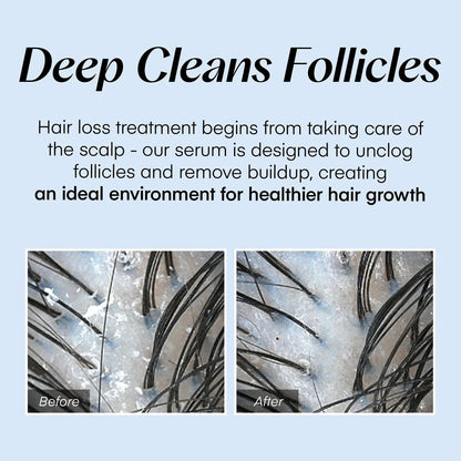 Alurain™ Serum – Revitalize fresh, thick hair and soothe your scalp all day long