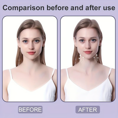FacioFix – Professional Tape for Instant Facial Tightening