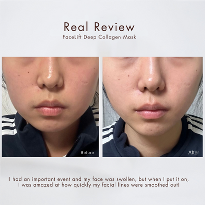 Alurain™ Collagen Mask | TODAY ONLY